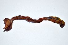 Detarched umblical cord.