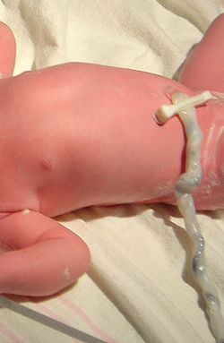Three minutes old baby with an uncut umbilical cord.