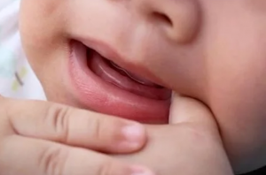 Toothless baby smile in How long do teething symptoms last in babies?