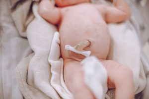 Newborn baby with umbilical cord.