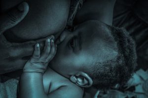 Breastfeeding a congested baby